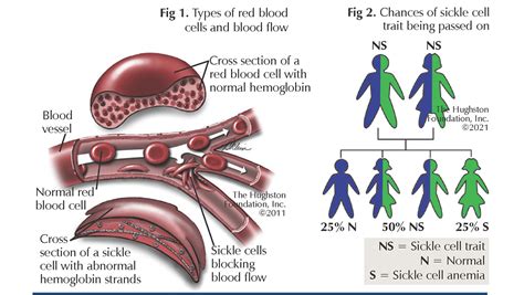 sickle cell trait dating